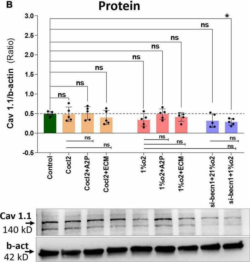 Hypoxia and Cocl2 exposure not significantly altered the H9c2 cells Cav1.1 (CACNA1S) mRNA and protein expression levels. (A) Cav1.1 mRNA expression levels, (B) Cav1.1 Protein expression levels, and representative western blots. Cav1.1 mRNA levels was increased in h9c2 cells exposed to Cocl2 + ECM (****p < 0.0001), and not changed significantly in Control vs. Cocl2, Cocl2 + A2P, 1%O2 + A2P, 1%O2 + ECM, and in Beclin-1 inhibition cells grown under normoxia and hypoxia conditions. Compared to Hypoxia (1%O2), cells exposed to 1%O2 + A2P (#p < 0.010), 1% O2 + ECM, (####p < 0.0001), and in Beclin-1 inhibition (###p < 0.0005) cells grown under Hypoxia expressed significant decrease in Cav1.1 mRNA levels. However, Cav 1.1 protein expression levels only decreased in (*p < 0.047) Beclin-1 inhibition cells under hypoxia and not significantly changed in all other experimental groups. Data represents, n = 3 (mRNA) and n = 5 (Protein) independent samples/group. Bars are mean +/- S.D. Symbols *, +, #, and ≠ denotes significant, “ns