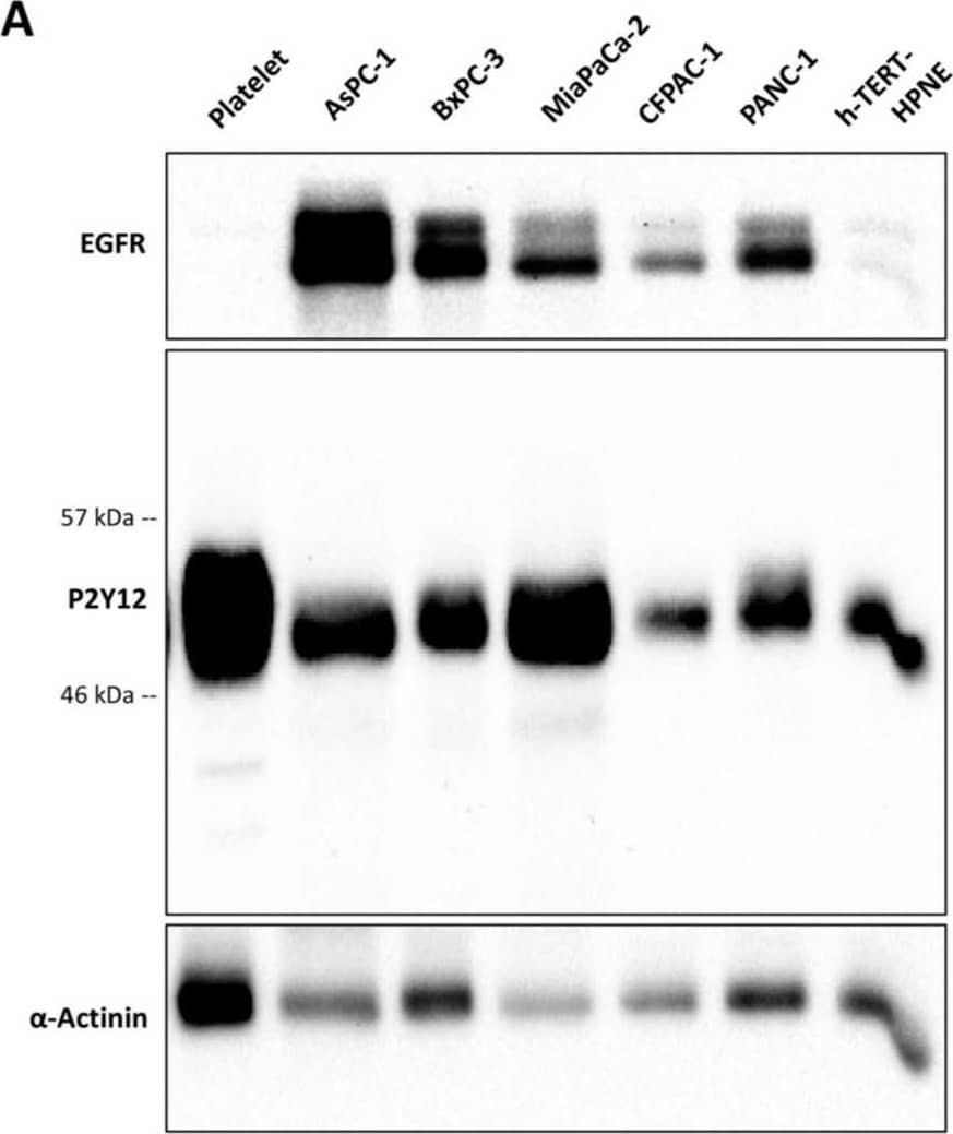 The P2Y12 receptor, activated by ADP, triggers AKT activation in PDAC cells. (A) Immunoblots show the expression of P2Y12 and EGFR in PDAC cells (AsPC-1, BxPC-3, MiaPaCa-2, CFPAC-1 and PANC-1) and the normal pancreatic duct cells h-TERT-HPNE. Platelets were used as a positive control for P2Y12. Cells were seeded at 3 × 105 cells/well in a 6-well plate for 24 h, then washed, lysed and the proteins were collected and quantified. (B,C) Relative P2Y12 and EGFR expression in five PDAC cell lines and h-TERT-HPNE cells. The expression level was quantified and normalised to the loading control,  alpha -actinin, with automated software Image Lab (version 5.1, BioRad, Hercules CA, USA) and represented as columns using GraphPad Prism 8 (GraphPad Software, Inc, CA, USA). (D) The P2Y12 inhibitor, ticagrelor, reduced ADP-induced AKT activation in AsPC-1 and BxPC-3. Briefly, cancer cells were seeded in a 12-well plate and after 24 h, cells were starved for 6 h, then treated with ticagrelor (5 uM) combined with ADP (100 uM) and the cells were further incubated for 30 min in serum-free media. The figure shows a representative blot from three independent experiments. (E) Extracellular ADP release from AsPC-1, BxPC-3, MiaPaCa-2 and h-TERT-HPNE. ADP was analysed in 250 uL of PBS previously incubated with cells for 15 min as described in the Methods and Materials section. The columns represent the mean of relative fluorescence units (RFU) from three independent experiments. (F) Western blot analysis of phospho-EGFR Y1068 (p-EGFR Y1068), phospho-AKT S473 (p-AKT S473) and phospho-ERK 1/2 (p-ERK1/2) expression in lysates derived from AsPC-1, BxPC-3 and h-TERT-HPNE treated with ADP (10, 50 and 100 uM) for 30 min. The figure shows a representative blot from three independent experiments. Image collected and cropped by CiteAb from the following open publication (//pubmed.ncbi.nlm.nih.gov/31968611), licensed under a CC-BY license. Not internally tested by Novus Biologicals.