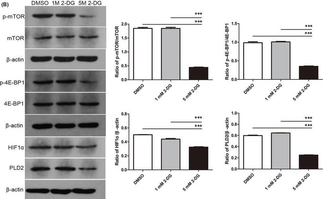 2‐DG inhibited glycolysis and mTOR pathway in OLP‐derived T cells. OLP‐derived T cells were activated with 1 μg/ml anti‐CD3 mAb and 2 μg/ml anti‐CD28 mAb for 72 h, then cultured with 1 mM or 5 mM 2‐DG for 24 h. 2‐DG was dissolved in DMSO. DMSO at a concentration of 0.1% (v/v) was used as the solvent control. (A) Representative images of immunofluorescent staining for LDHA expression in T cells. The fluorescence intensity of LDHA was decreased in the 2‐DG groups. 5 mM 2‐DG group showed a weaker fluorescence than 1 mM 2‐DG group. Red: LDHA. Blue: nucleus. Bar: 50 μm for ×400. (B) Representative images of Western Blot detection for p‐mTOR, mTOR, p‐4E‐BP1, 4E‐BP1, HIF1 alpha  and PLD2 expression. Grey‐scale analysis revealed that the ratios of p‐mTOR/mTOR, p‐4E‐BP1/4E‐BP1, HIF1 alpha / beta ‐actin and PLD2/ beta ‐actin were decreased in 5 mM 2‐DG group, rather than in 1 mM 2‐DG group. ***, p < 0.001 Image collected and cropped by CiteAb from the following open publication (//pubmed.ncbi.nlm.nih.gov/34672419), licensed under a CC-BY license. Not internally tested by Novus Biologicals.