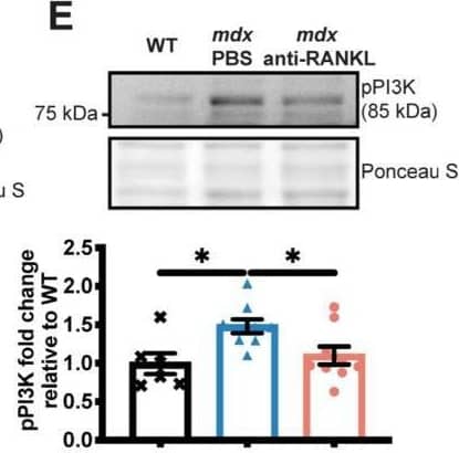 An anti-RANKL treatment reduces the cardiomyocyte surface and inhibits cardiac hypertrophy mediators in dystrophic mice. The heart tissues were sectioned and were incubated with laminin (green), rhodamine-phalloidin (red), and DAPI (blue) markers to label the cardiomyocyte membrane, F-actin filaments, and nuclei, respectively, at 20× magnification (A). The cardiomyocyte mean cross-sectional area (CSA) (A) and CSA distribution (B). Western blot analyses of pNF kappa B (C), NF kappa B (D), pPI3K (E), and PI3K (F) protein levels. The scale bar in A represents 0.05 mm. Results are expressed as means +/- SEM (* p < 0.05, ** p < 0.01, *** p < 0.001, and **** p < 0.0001). Shown are an analysis of variance one-way ANOVA with a Tuckey correction for the CSA and western blots (A,D–F), and an analysis of variance two-way ANOVA with a Bonferroni correction for a distribution analysis (B). N = 3 for WT, n = 6 for mdx-PBS, and n = 9 for mdx-anti-RANKL for the cardiomyocyte CSA (A) and distribution (B). N = 3–6 for WT, n = 5–10 for mdx-PBS, and n = 5–9 for mdx-anti-RANKL for the western blots (C–F). Image collected and cropped by CiteAb from the following open publication (//pubmed.ncbi.nlm.nih.gov/37296659), licensed under a CC-BY license. Not internally tested by Novus Biologicals.
