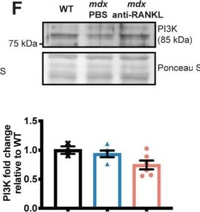 An anti-RANKL treatment reduces the cardiomyocyte surface and inhibits cardiac hypertrophy mediators in dystrophic mice. The heart tissues were sectioned and were incubated with laminin (green), rhodamine-phalloidin (red), and DAPI (blue) markers to label the cardiomyocyte membrane, F-actin filaments, and nuclei, respectively, at 20× magnification (A). The cardiomyocyte mean cross-sectional area (CSA) (A) and CSA distribution (B). Western blot analyses of pNF kappa B (C), NF kappa B (D), pPI3K (E), and PI3K (F) protein levels. The scale bar in A represents 0.05 mm. Results are expressed as means +/- SEM (* p < 0.05, ** p < 0.01, *** p < 0.001, and **** p < 0.0001). Shown are an analysis of variance one-way ANOVA with a Tuckey correction for the CSA and western blots (A,D–F), and an analysis of variance two-way ANOVA with a Bonferroni correction for a distribution analysis (B). N = 3 for WT, n = 6 for mdx-PBS, and n = 9 for mdx-anti-RANKL for the cardiomyocyte CSA (A) and distribution (B). N = 3–6 for WT, n = 5–10 for mdx-PBS, and n = 5–9 for mdx-anti-RANKL for the western blots (C–F). Image collected and cropped by CiteAb from the following open publication (//pubmed.ncbi.nlm.nih.gov/37296659), licensed under a CC-BY license. Not internally tested by Novus Biologicals.