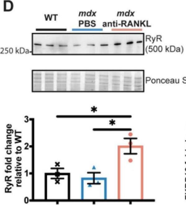 An anti-RANKL treatment increases SERCA activity and modulates intracellular calcium homeostasis regulators in the dystrophic heart. SERCA activity (A), western blot analyses of SERCA2a (B), phospholamban (PLN) (C), Ryanodine (RyR) (D), and FKBP12 (E) protein levels in hearts from WT, PBS-injected mdx, and anti-RANKL-treated mdx mice. Results are expressed as means +/- SEM (* p < 0.05, ** p < 0.01, *** p < 0.001, and **** p < 0.0001). Shown are an analysis of variance two-way ANOVA with a Bonferroni correction (A) and an analysis of variance one-way ANOVA with a Tuckey correction for western blots (B–E). N = 11 for WT, mdx-PBS, and mdx-anti-RANKL for SERCA activity (A); n = 3–8 for WT, mdx-PBS, and mdx-anti-RANKL for Western blots (B–E). Image collected and cropped by CiteAb from the following open publication (//pubmed.ncbi.nlm.nih.gov/37296659), licensed under a CC-BY license. Not internally tested by Novus Biologicals.