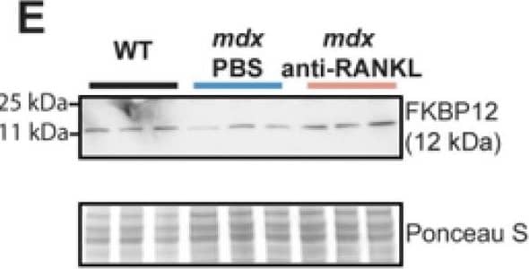 An anti-RANKL treatment increases SERCA activity and modulates intracellular calcium homeostasis regulators in the dystrophic heart. SERCA activity (A), western blot analyses of SERCA2a (B), phospholamban (PLN) (C), Ryanodine (RyR) (D), and FKBP12 (E) protein levels in hearts from WT, PBS-injected mdx, and anti-RANKL-treated mdx mice. Results are expressed as means +/- SEM (* p < 0.05, ** p < 0.01, *** p < 0.001, and **** p < 0.0001). Shown are an analysis of variance two-way ANOVA with a Bonferroni correction (A) and an analysis of variance one-way ANOVA with a Tuckey correction for western blots (B–E). N = 11 for WT, mdx-PBS, and mdx-anti-RANKL for SERCA activity (A); n = 3–8 for WT, mdx-PBS, and mdx-anti-RANKL for Western blots (B–E). Image collected and cropped by CiteAb from the following open publication (//pubmed.ncbi.nlm.nih.gov/37296659), licensed under a CC-BY license. Not internally tested by Novus Biologicals.