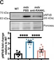 An anti-RANKL treatment reduces the cardiomyocyte surface and inhibits cardiac hypertrophy mediators in dystrophic mice. The heart tissues were sectioned and were incubated with laminin (green), rhodamine-phalloidin (red), and DAPI (blue) markers to label the cardiomyocyte membrane, F-actin filaments, and nuclei, respectively, at 20× magnification (A). The cardiomyocyte mean cross-sectional area (CSA) (A) and CSA distribution (B). Western blot analyses of pNF kappa B (C), NF kappa B (D), pPI3K (E), and PI3K (F) protein levels. The scale bar in A represents 0.05 mm. Results are expressed as means +/- SEM (* p < 0.05, ** p < 0.01, *** p < 0.001, and **** p < 0.0001). Shown are an analysis of variance one-way ANOVA with a Tuckey correction for the CSA and western blots (A,D–F), and an analysis of variance two-way ANOVA with a Bonferroni correction for a distribution analysis (B). N = 3 for WT, n = 6 for mdx-PBS, and n = 9 for mdx-anti-RANKL for the cardiomyocyte CSA (A) and distribution (B). N = 3–6 for WT, n = 5–10 for mdx-PBS, and n = 5–9 for mdx-anti-RANKL for the western blots (C–F). Image collected and cropped by CiteAb from the following open publication (//pubmed.ncbi.nlm.nih.gov/37296659), licensed under a CC-BY license. Not internally tested by Novus Biologicals.