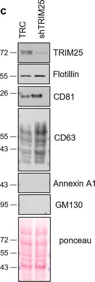 K63-Ubiquitinated FMR1 undergoes ESCRT-dependent EV loading. (A) Pulldown of FMR1 shows that it interacts with Hrs after inflammasome activation. This interaction is lost when TRIM25 is silenced (shT25). (B-C) Knockdown of TRIM25 does not alter the number of EVs secreted or the contents of known exosome markers. EV numbers were quantified via Bradford dye as performed by us previously15. (D) Silencing TRIM25 dramatically reduces the EV enrichment of FMR1 during inflammation. (E) Correlation between the amount of intracellular TRIM25 and the amount of EV-associated FMR1. The amount of intracellular TRIM25 is positively correlated with EV FMR1. THP-1 cells were used for this figure. Data are shown as mean +/- SEM; *p ≤ 0.05 for n = 3–5. Image collected and cropped by CiteAb from the following open publication (//pubmed.ncbi.nlm.nih.gov/38135735), licensed under a CC-BY license. Not internally tested by Novus Biologicals.