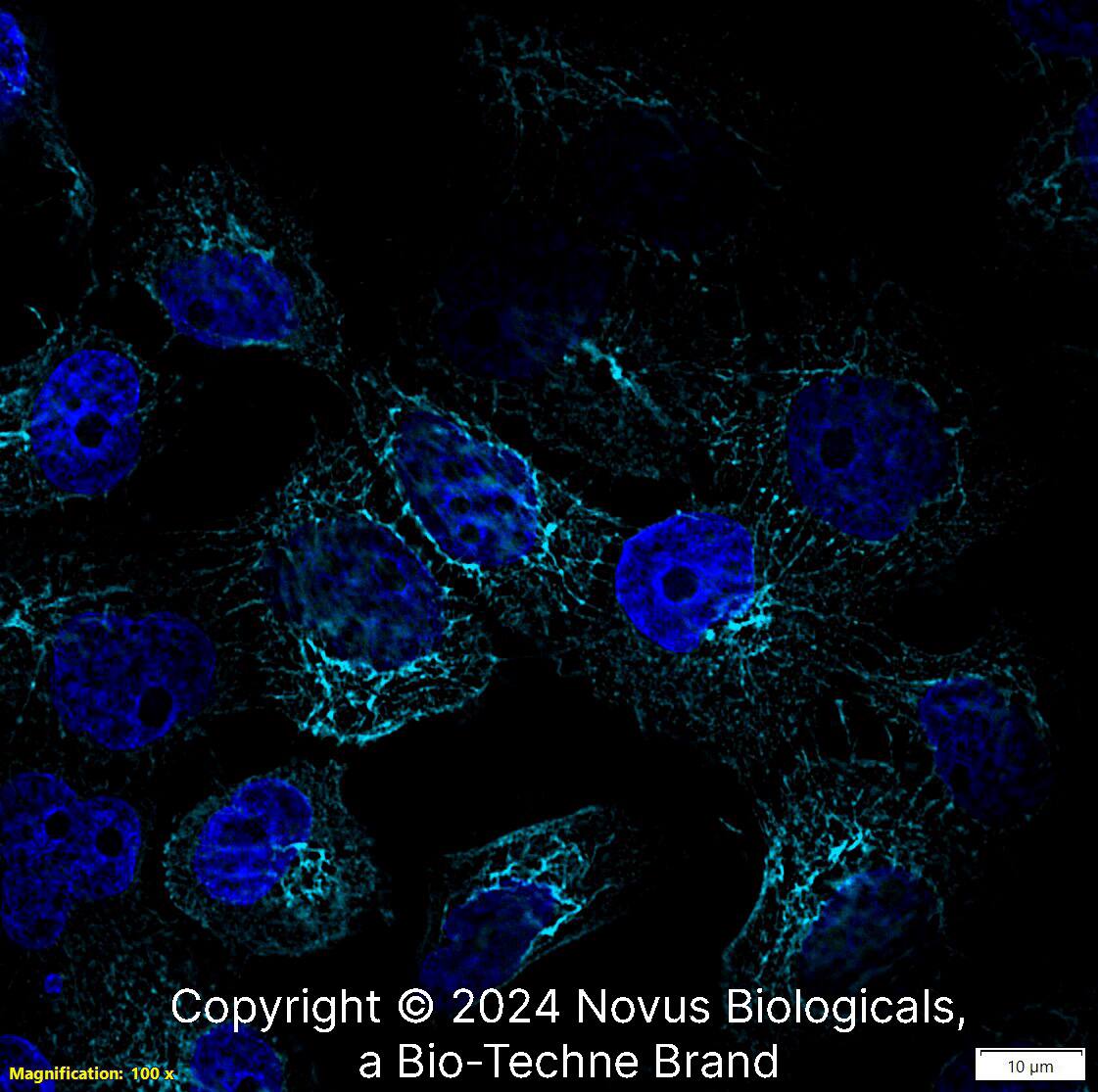 Cytokeratin 5 was detected in immersion fixed A431 human skin carcinoma cell line using Rabbit anti-Cytokeratin 5 Antigen Affinity Purified Polyclonal Antibody conjugated to Alexa Fluor® 647 (Catalog # NBP2-61931AF647) (light blue) at 10 µg/mL overnight at 4C. Cells were counterstained with DAPI (blue). Cells were imaged using a 100X objective and digitally deconvolved.