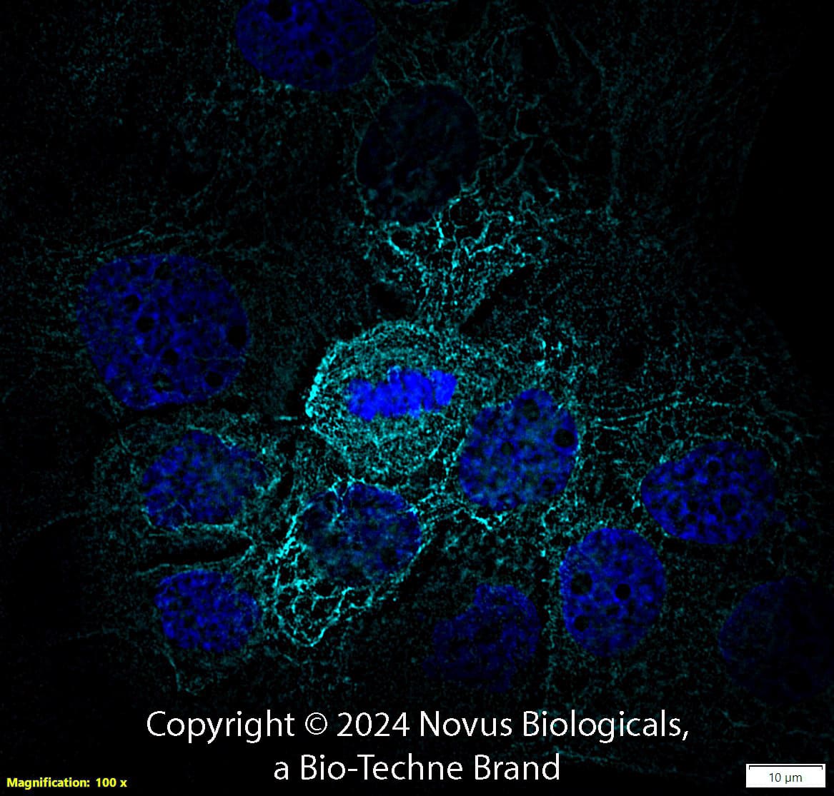 Cytokeratin 5 was detected in immersion fixed A431 human skin carcinoma cell line using Rabbit anti-Cytokeratin 5 Affinity Purified Polyclonal Antibody conjugated to Alexa Fluor® 647 (Catalog # NBP2-61931AF647) (red) at 10 µg/mL overnight at 4C. Cells were counterstained with DAPI (blue). Cells were imaged using a 100X objective and digitally deconvolved.  