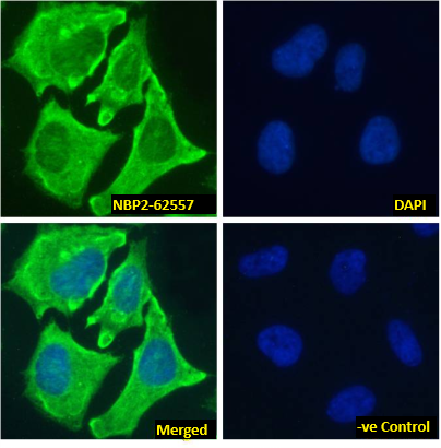 Immunocytochemistry /Immunofluorescence: Notch-1 Antibody (E6) - Chimeric - Azide and BSA Free [NBP2-62557] - Immunofluorescence analysis of paraformaldehyde fixed HeLa cells, permeabilized with 0.15% Triton stained with NBP2-62557 at 10 ug/ml for 1h followed by Alexa Fluor 488 secondary antibody (1 ug/ml), showing membrane and cytoplasmic staining. The nuclear stain is DAPI (blue). Panels show from left-right, top-bottom NBP2-62557, DAPI, merged channels and a negative control. The negative control was stained with unimmunized rabbit IgG followed by Alexa Fluor 488 secondary antibody.
