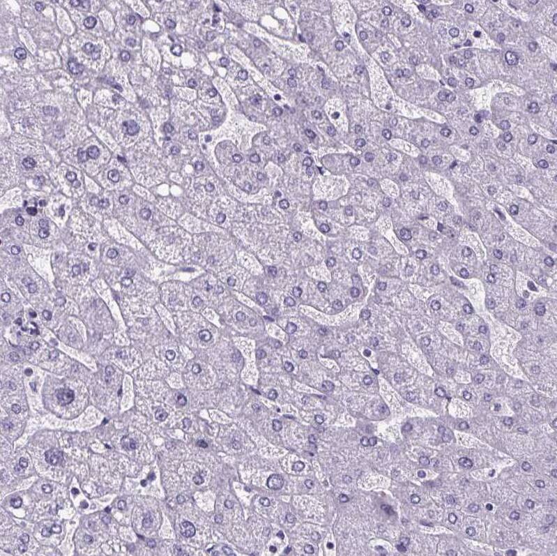 Immunohistochemistry-Paraffin Cubilin Antibody - BSA Free