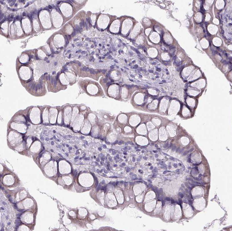 Immunohistochemistry-Paraffin Cubilin Antibody - BSA Free