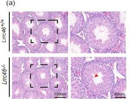 Spermatogenesis defects of Lrrc46 knockout mice. (a) HE-staining of testes sections from the Lrrc46+/+ and Lrrc46−/− male mice. (b) IF of anti-alpha / beta -tubulin (red) antibodies in testes sections from the Lrrc46+/+ and Lrrc46−/− male mice. (c) The PAS and HE-staining analysis of the testis seminiferous tubule cross-sections of Lrrc46+/+ and Lrrc46−/− male mice. The arrows highlight germ cells at various stages of spermatogenesis. Defects in the nuclear shape of several elongating spermatids were clearly evident in the Lrrc46−/− male mice seminiferous tubule (red circle). P: pachytene spermatocyte, D: diploneme spermatocyte, Z: zygotene spermatocyte, M: meiotic spermatocyte, rST: round spermatid, eST: elongating spermatid, spz: spermatozoa. (d) The PAS and HE-staining analysis of spermatids at different steps from Lrrc46+/+ and Lrrc46−/− male mice. During step 1 to step 10 spermatids of acrosome development period, the sperm acrosome morphology was roughly normal in the Lrrc46−/− male mice. During step 11 to step 18, te spermatids head shaping period, the sperm had an abnormal, club-shaped sperm head morphology in Lrrc46−/− male mice while Lrrc46+/+ mice had normal, hook shaped heads. Image collected and cropped by CiteAb from the following open publication (//pubmed.ncbi.nlm.nih.gov/35955660), licensed under a CC-BY license. Not internally tested by Novus Biologicals.