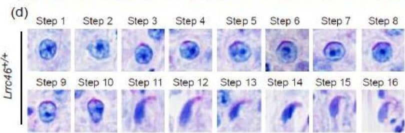 Spermatogenesis defects of Lrrc46 knockout mice. (a) HE-staining of testes sections from the Lrrc46+/+ and Lrrc46−/− male mice. (b) IF of anti-alpha / beta -tubulin (red) antibodies in testes sections from the Lrrc46+/+ and Lrrc46−/− male mice. (c) The PAS and HE-staining analysis of the testis seminiferous tubule cross-sections of Lrrc46+/+ and Lrrc46−/− male mice. The arrows highlight germ cells at various stages of spermatogenesis. Defects in the nuclear shape of several elongating spermatids were clearly evident in the Lrrc46−/− male mice seminiferous tubule (red circle). P: pachytene spermatocyte, D: diploneme spermatocyte, Z: zygotene spermatocyte, M: meiotic spermatocyte, rST: round spermatid, eST: elongating spermatid, spz: spermatozoa. (d) The PAS and HE-staining analysis of spermatids at different steps from Lrrc46+/+ and Lrrc46−/− male mice. During step 1 to step 10 spermatids of acrosome development period, the sperm acrosome morphology was roughly normal in the Lrrc46−/− male mice. During step 11 to step 18, te spermatids head shaping period, the sperm had an abnormal, club-shaped sperm head morphology in Lrrc46−/− male mice while Lrrc46+/+ mice had normal, hook shaped heads. Image collected and cropped by CiteAb from the following open publication (//pubmed.ncbi.nlm.nih.gov/35955660), licensed under a CC-BY license. Not internally tested by Novus Biologicals.