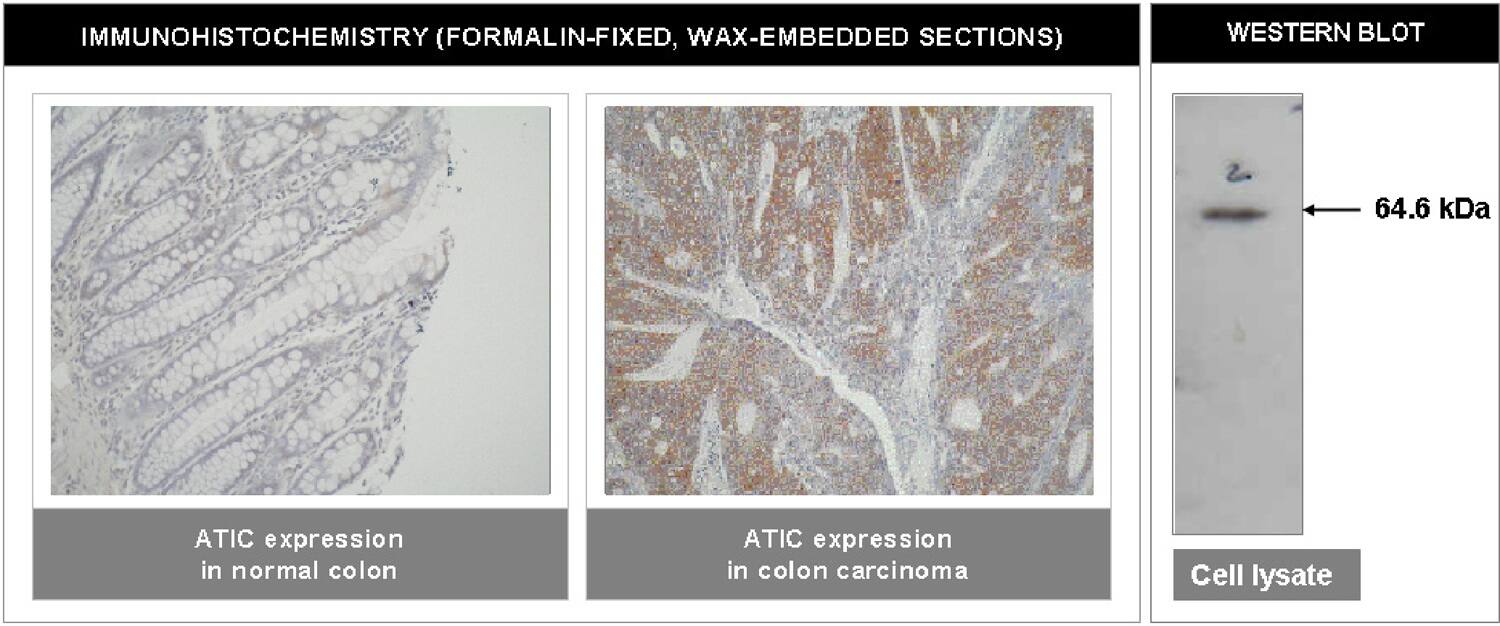 Immunohistochemistry ATIC Antibody (F38 P7 H9)