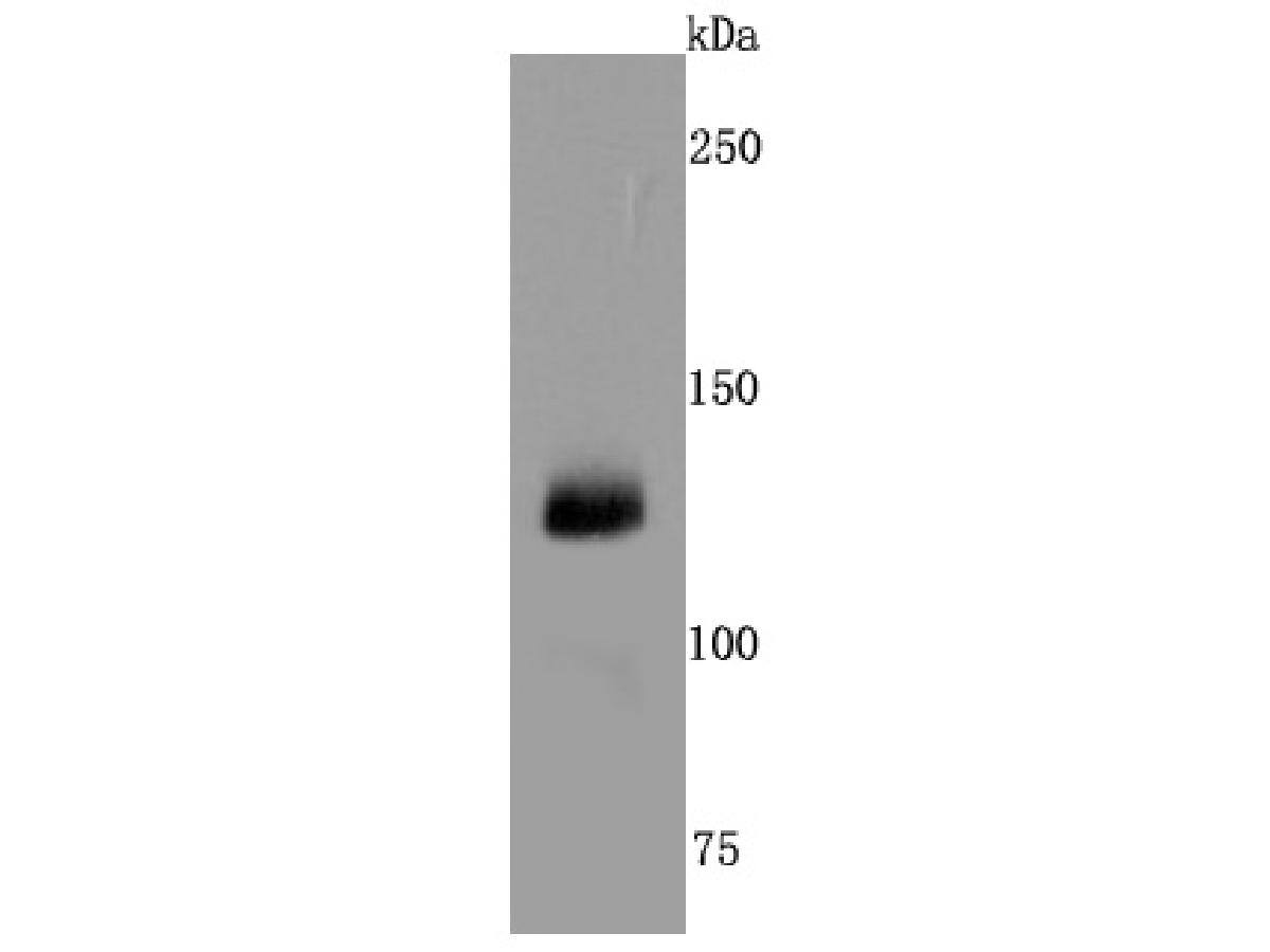 Western blot analysis of CD41 on human placenta tissue lysates. Proteins were transferred to a PVDF membrane and blocked with 5% BSA in PBS for 1 hour at room temperature. The primary antibody (NBP2-66757, 1/500) was used in 5% BSA at room temperature for 2 hours. Goat Anti-Rabbit IgG [HRP] Secondary Antibody at 1:200,000 dilution was used for 1 hour at room temperature.