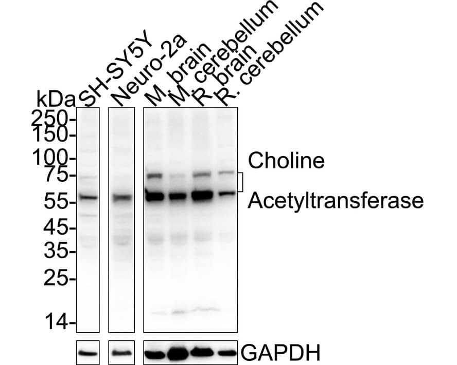 Western blot analysis on different lysates with NBP2-66779 at 1/5,000 dilution. Lane 1: SH-SY5Y cell lysate (20 µg/Lane) Lane 2: Neuro-2a cell lysate (negative) (20 µg/Lane) Lane 3: Mouse brain tissue lysate (40 µg/Lane) Lane 4: Mouse cerebellum tissue lysate (40 µg/Lane) Lane 5: Rat brain tissue lysate (40 µg/Lane) Lane 6: Rat cerebellum tissue lysate (40 µg/Lane) Predicted band size: 83 kDa Observed band size: 50/75 kDa Exposure time: 5 seconds;  4-20% SDS-PAGE gel. Proteins were transferred to a PVDF membrane and blocked with 5% NFDM/TBST for 1 hour at room temperature. NBP2-66779 at 1/5,000 dilution was used in primary antibody dilution at room temperature for 2 hours. Goat Anti-Rabbit IgG [HRP] Secondary Antibody at 1/50,000 dilution was used for 1 hour at room temperature.