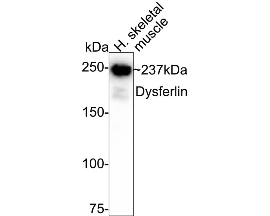 Western blot analysis of  human skeletal muscle tissue lysates with NBP2-66814 at 1/1,000 dilution. Lysates/proteins at 20 µg/Lane. Predicted band size: 237 kDa Observed band size: 237 kDa Exposure time: 3 minutes;  6% SDS-PAGE gel. Proteins were transferred to a PVDF membrane and blocked with 5% NFDM/TBST for 1 hour at room temperature. NBP2-66814 at 1/1,000 dilution was used in 5% NFDM/TBST at room temperature for 2 hours. Goat Anti-Rabbit IgG [HRP] Secondary Antibody at 1/50,000 dilution was used for 1 hour at room temperature.