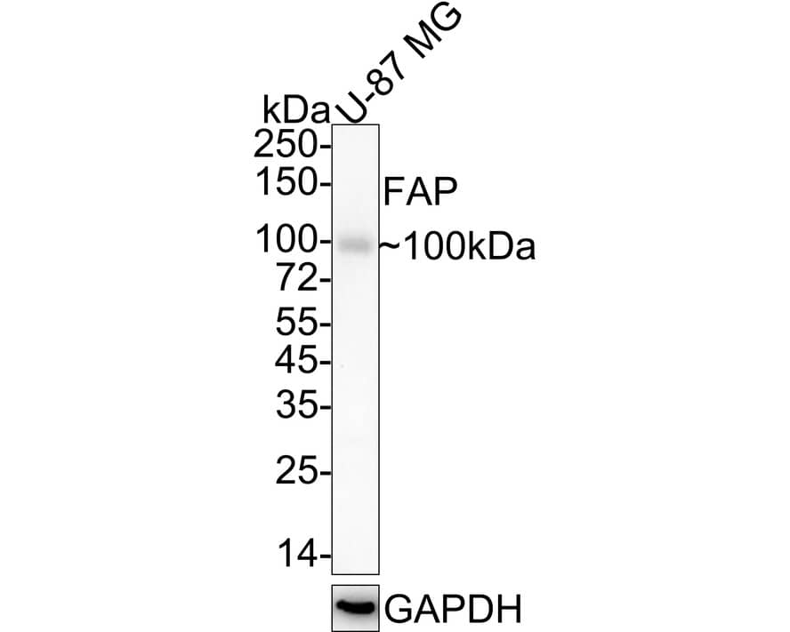 <b>Biological Strategies Validation. </b>Western blot analysis of  U-87 MG cell lysates with NBP2-66844 at 1/1,000 dilution. Lysates/proteins at 20 µg/Lane. Predicted band size: 88 kDa Observed band size: 100 kDa Exposure time: 5 minutes;  4-20% SDS-PAGE gel. Proteins were transferred to a PVDF membrane and blocked with 5% NFDM/TBST for 1 hour at room temperature. NBP2-66844 at 1/1,000 dilution was used in 5% NFDM/TBST at 4℃ overnight. Goat Anti-Rabbit IgG [HRP] Secondary Antibody at 1/50,000 dilution was used for 1 hour at room temperature.