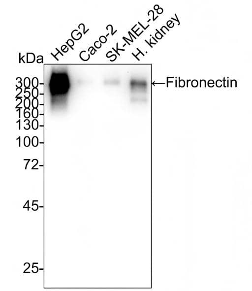 Western blot analysis on different lysates with NBP2-66845 at 1/2,000 dilution and competitor's antibody at 1/2,000 dilution. Lane 1: HepG2 cell lysate Lane 2: Caco-2 cell lysate Lane 3: SK-MEL-28 cell lysate Lane 4: Human kidney tissue lysate Lysates/proteins at 20 µg/Lane. Predicted band size: 272 kDa Observed band size: 272 kDa Exposure time: 3 minutes 20 seconds;  4-20% SDS-PAGE gel. Proteins were transferred to a PVDF membrane and blocked with 5% NFDM/TBST for 1 hour at room temperature. NBP2-66845 at 1/2,000 dilution and competitor's antibody at 1/2,000 dilution were used in 5% NFDM/TBST at 4℃ overnight. Goat Anti-Rabbit IgG [HRP] Secondary Antibody at 1/50,000 dilution was used for 1 hour at room temperature.