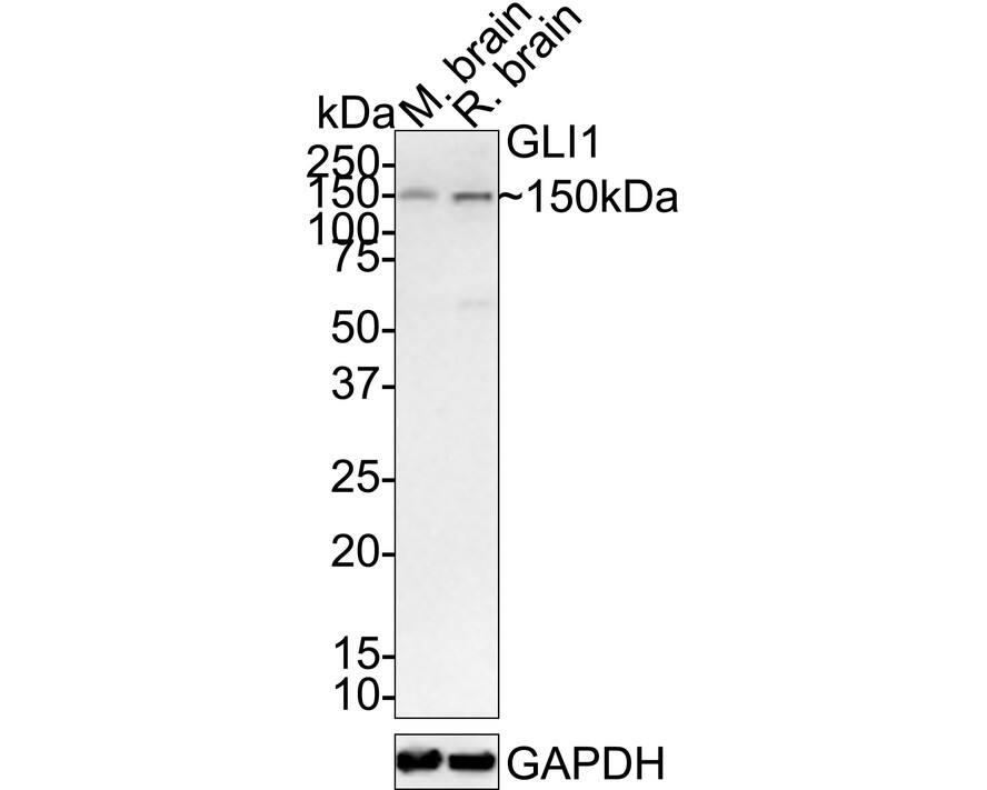Western blot analysis on different lysates with NBP2-66867 at 1/1,000 dilution. Lane 1: Mouse brain tissue lysate Lane 2: Rat brain tissue lysate Lysates/proteins at 20 µg/Lane. Predicted band size: 118 kDa Observed band size: 150 kDa Exposure time: 1 minute 22 seconds; 4-20% SDS-PAGE gel. Proteins were transferred to a PVDF membrane and blocked with 5% NFDM/TBST for 1 hour at room temperature. NBP2-66867 at 1/1,000 dilution was used in 5% NFDM/TBST at 4℃ overnight. Goat Anti-Rabbit IgG [HRP] Secondary Antibody at 1/50,000 dilution was used for 1 hour at room temperature.