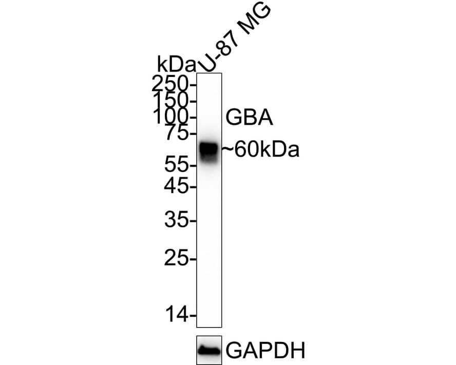 Western blot analysis of  U-87 MG cell lysates with NBP2-66871 at 1/2,000 dilution. Lysates/proteins at 20 µg/Lane. Predicted band size: 60 kDa Observed band size: 60 kDa Exposure time: 1 minute 2 seconds;  4-20% SDS-PAGE gel. Proteins were transferred to a PVDF membrane and blocked with 5% NFDM/TBST for 1 hour at room temperature. NBP2-66871 at 1/2,000 dilution was used in 5% NFDM/TBST at 4℃ overnight. Goat Anti-Rabbit IgG [HRP] Secondary Antibody at 1/50,000 dilution was used for 1 hour at room temperature.