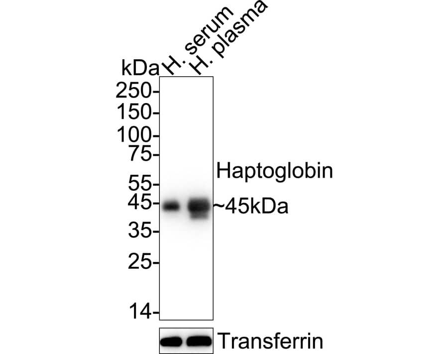 Western blot analysis on different lysates with NBP2-66881 at 1/1,000 dilution. Lane 1: Human serum lysate Lane 2: Human plasma lysate Lysates/proteins at 20 µg/Lane. Predicted band size: 45 kDa Observed band size: 45 kDa Exposure time: 2 seconds;  4-20% SDS-PAGE gel. Proteins were transferred to a PVDF membrane and blocked with 5% NFDM/TBST for 1 hour at room temperature. NBP2-66881 at 1/1,000 dilution was used in 5% NFDM/TBST at 4℃ overnight. Goat Anti-Rabbit IgG [HRP] Secondary Antibody at 1/50,000 dilution was used for 1 hour at room temperature.