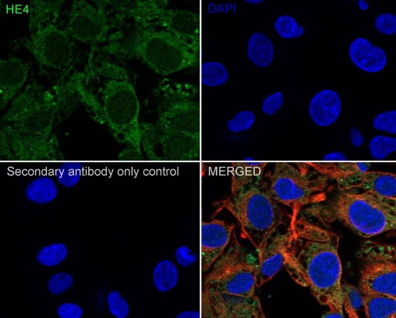 Immunocytochemistry/Immunofluorescence: HE4/WFDC2 Antibody (JF62-09) [NBP2-66883] - analysis of HepG2 cells labeling HE4 with Rabbit anti-HE4 antibody at 1/100 dilution.Cells were fixed in 4% paraformaldehyde for 20 minutes at room temperature, permeabilized with 0.1% Triton X-100 in PBS for 5 minutes at room temperature, then blocked with 1% BSA in 10% negative goat serum for 1 hour at room temperature. Cells were then incubated with Rabbit anti-HE4 antibody at 1/100 dilution in 1% BSA in PBST overnight at 4 ℃. Goat Anti-Rabbit IgG H&L (iFluor™ 488,) was used as the secondary antibody at 1/1,000 dilution. PBS instead of the primary antibody was used as the secondary antibody only control. Nuclear DNA was labelled in blue with DAPI.Beta tubulin ( red) was stained at 1/100 dilution overnight at +4c. Goat Anti-Mouse IgG H&L (iFluor™ 594) was used as the secondary antibody at 1/1,000 dilution.