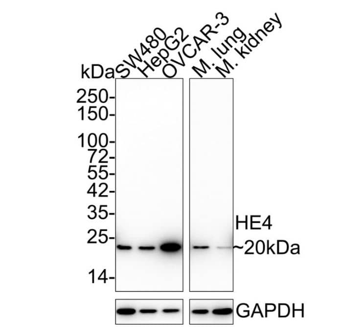 Western Blot: HE4/WFDC2 Antibody (JF62-09) [NBP2-66883] - analysis of HE4 on different lysates with Rabbit anti-HE4 antibody (ET1702-61) at 1/2,000 dilution.Lane 1: SW480 cell lysate (15 ug/Lane)Lane 2: HepG2 cell lysate (15 ug/Lane)Lane 3: OVCAR-3 cell lysate (15 ug/Lane)Lane 4: Mouse lung tissue lysate (20 ug/Lane)Lane 5: Mouse kidney tissue lysate (20 ug/Lane)Predicted band size: 13 kDaObserved band size: 20 kDaExposure time: 1 minute;4-20% SDS-PAGE gel.Proteins were transferred to a PVDF membrane and blocked with 5% NFDM/TBST for 1 hour at room temperature. The primary antibody at 1/2,000 dilution was used in 5% NFDM/TBST at 4℃ overnight. Goat Anti-Rabbit IgG - HRP Secondary Antibody (HA1001) at 1/50,000 dilution was used for 1 hour at room temperature.