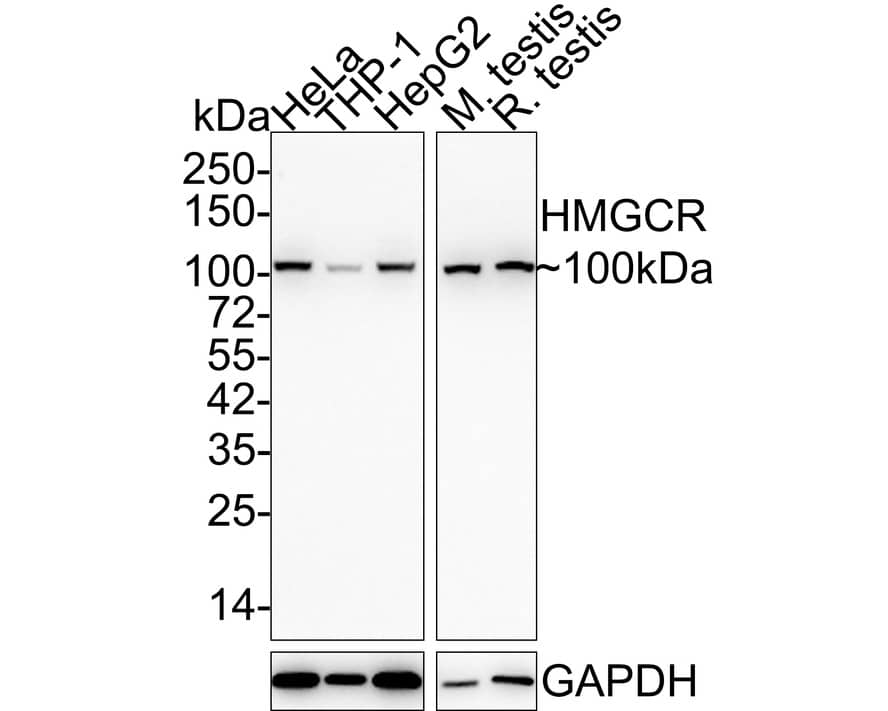 Western Blot HMG-CoA Reductase/HMGCR Antibody (JF0981)