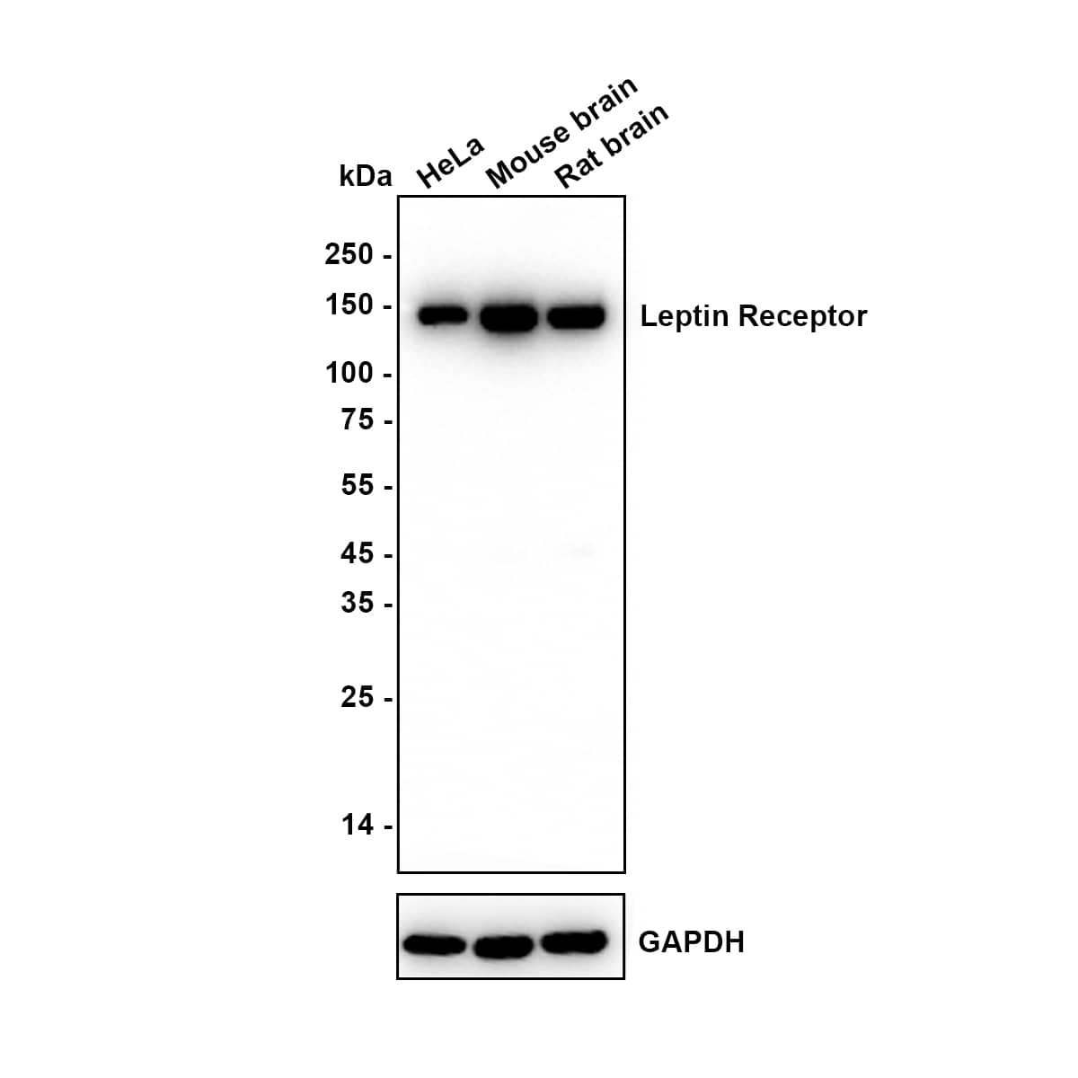 Western Blot Leptin R Antibody (JA73-01)