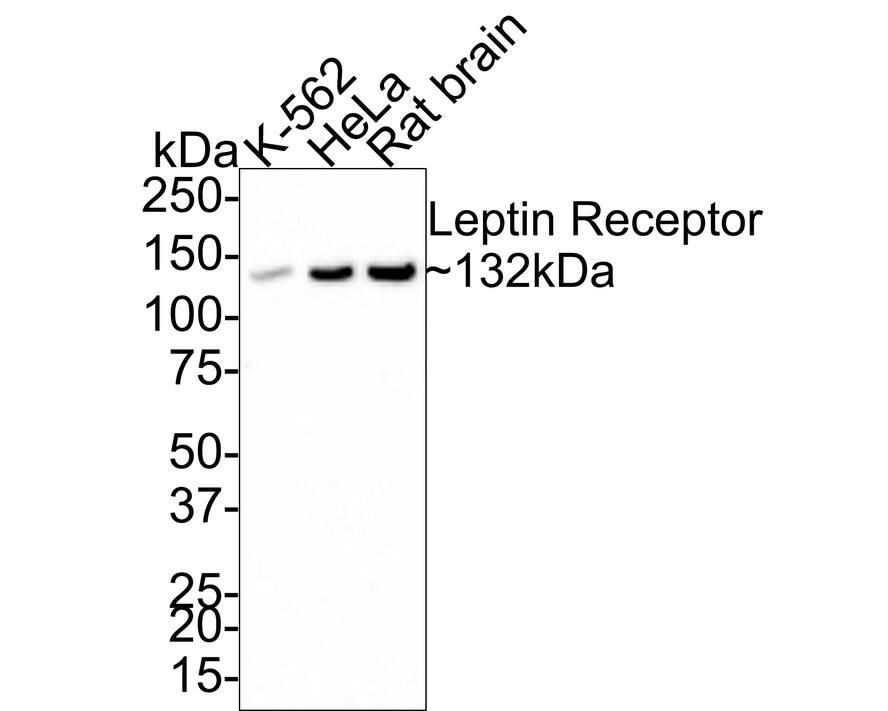 Western Blot Leptin R Antibody (JA73-01)