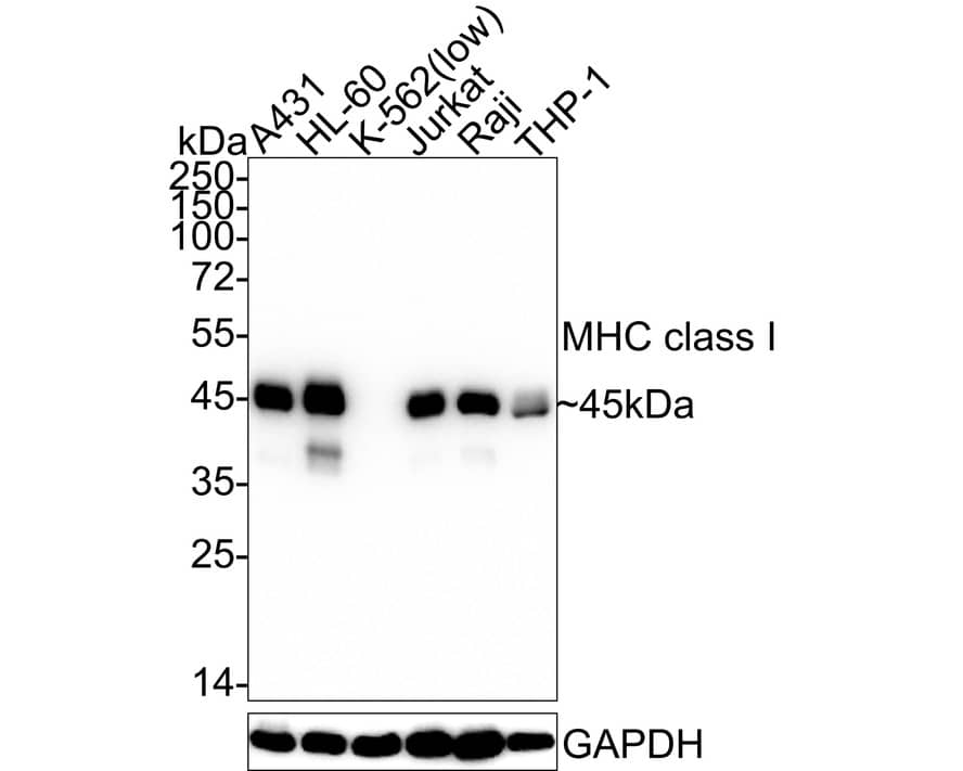 Western blot analysis on different lysates with NBP2-66946 at 1/1,000 dilution. Lane 1: A431 cell lysate Lane 2: HL-60 cell lysate Lane 3: K-562 cell lysate (low expression) Lane 4: Jurkat cell lysate Lane 5: Raji cell lysate Lane 6: THP-1 cell lysate Lysates/proteins at 20 µg/Lane. Predicted band size: 41 kDa Observed band size: 45 kDa Exposure time: 1 minute;  4-20% SDS-PAGE gel. Proteins were transferred to a PVDF membrane and blocked with 5% NFDM/TBST for 1 hour at room temperature. NBP2-66946 at 1/1,000 dilution was used in 5% NFDM/TBST at 4℃ overnight. Goat Anti-Rabbit IgG [HRP] Secondary Antibody at 1/50,000 dilution was used for 1 hour at room temperature.