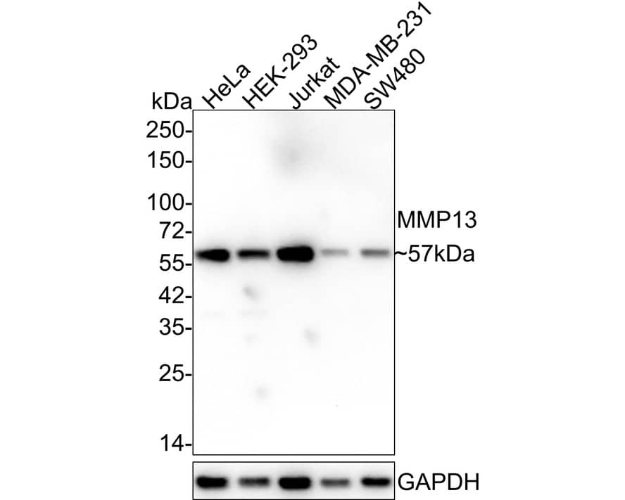 Western blot analysis on different lysates with NBP2-66954 at 1/2,000 dilution. Lane 1: HeLa cell lysate Lane 2: HEK-293 cell lysate Lane 3: Jurkat cell lysate Lane 4: MDA-MB-231 cell lysate Lane 5: SW480 cell lysate Lysates/proteins at 15 µg/Lane. Predicted band size: 54 kDa Observed band size: 57 kDa Exposure time: 1 minute 2 seconds; 4-20% SDS-PAGE gel. Proteins were transferred to a PVDF membrane and blocked with 5% NFDM/TBST for 1 hour at room temperature. NBP2-66954 at 1/2,000 dilution was used in 5% NFDM/TBST at 4℃ overnight. Goat Anti-Rabbit IgG [HRP] Secondary Antibody at 1/50,000 dilution was used for 1 hour at room temperature.