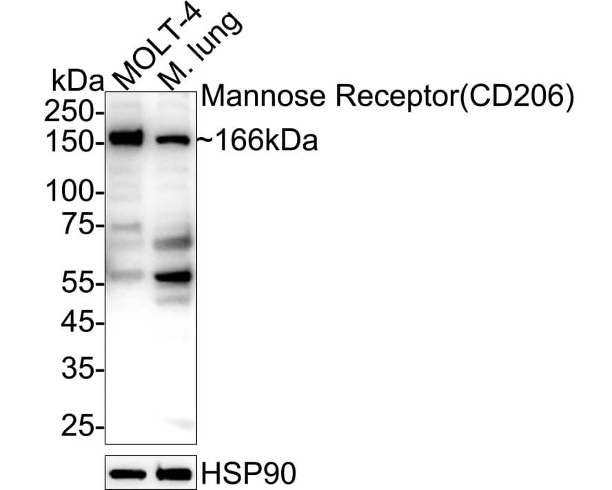 Western blot analysis on different lysates with NBP2-66956 at 1/5,000 dilution. Lane 1: MOLT-4 cell lysate (20 µg/Lane) Lane 2: Mouse lung tissue lysate (40 µg/Lane) Predicted band size: 166 kDa Observed band size: 166 kDa Exposure time: 18 seconds;  4-20% SDS-PAGE gel. Proteins were transferred to a PVDF membrane and blocked with 5% NFDM/TBST for 1 hour at room temperature. NBP2-66956 at 1/5,000 dilution was used in primary antibody dilution at 4℃ overnight. Goat Anti-Rabbit IgG [HRP] Secondary Antibody at 1/50,000 dilution was used for 1 hour at room temperature.