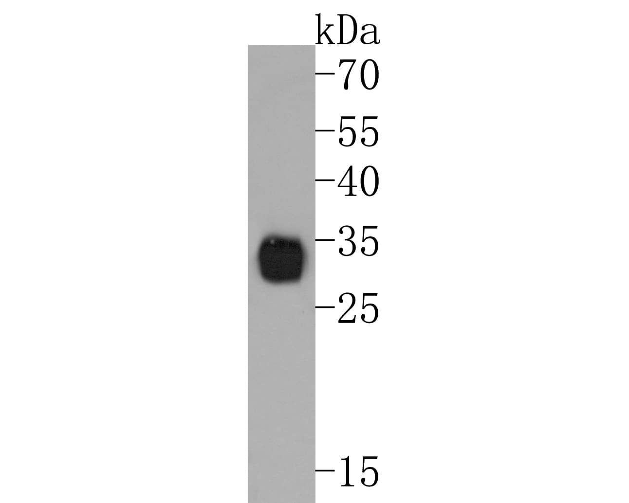 Western Blot Neutrophil Elastase/ELA2 Antibody (JF098-6)