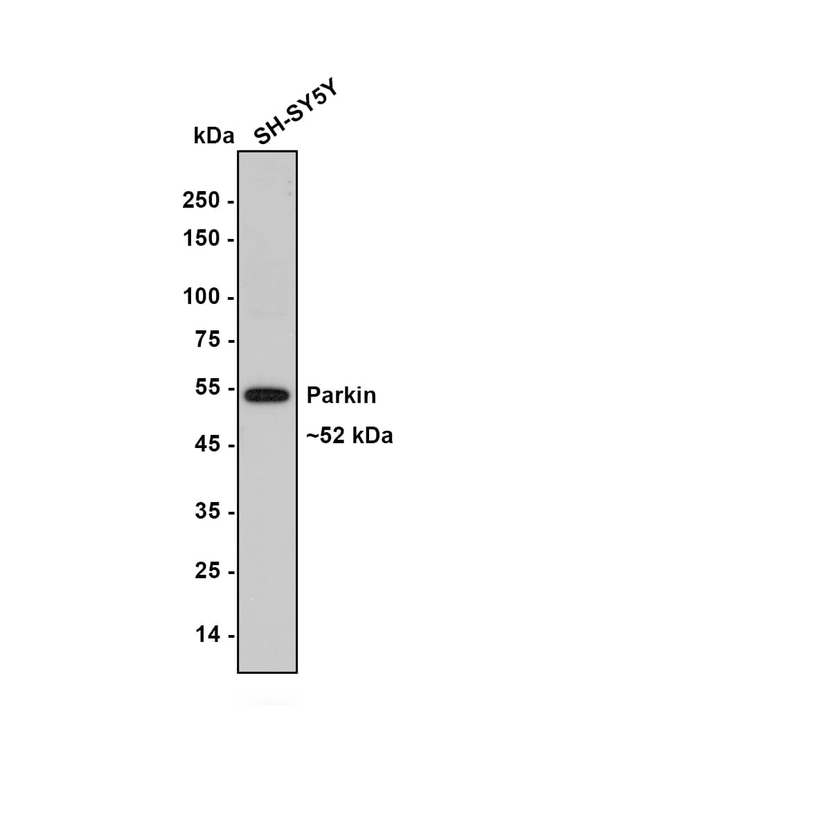 Western Blot Parkin Antibody (JF82-09)
