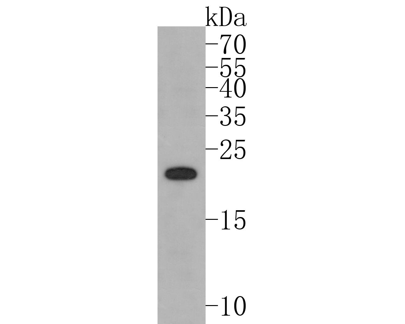 Western blot analysis of PMP22 on PC-12 cell lysates. Proteins were transferred to a PVDF membrane and blocked with 5% BSA in PBS for 1 hour at room temperature. The primary antibody (NBP2-67068, 1/500) was used in 5% BSA at room temperature for 2 hours. Goat Anti-Rabbit IgG [HRP] Secondary Antibody at 1:5,000 dilution was used for 1 hour at room temperature.