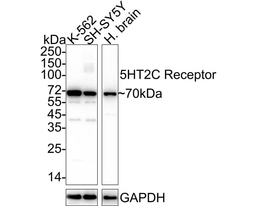 Western blot analysis on different lysates with NBP2-67100 at 1/1,000 dilution. Lane 1: K-562 cell lysate (15 µg/Lane) Lane 2: SH-SY5Y cell lysate (15 µg/Lane) Lane 3: Human brain tissue lysate (30 µg/Lane) Predicted band size: 52 kDa Observed band size: 70 kDa Exposure time: 1 minute 2 seconds;  4-20% SDS-PAGE gel. Proteins were transferred to a PVDF membrane and blocked with 5% NFDM/TBST for 1 hour at room temperature. NBP2-67100 at 1/1,000 dilution was used in 5% NFDM/TBST at 4℃ overnight. Goat Anti-Rabbit IgG [HRP] Secondary Antibody at 1/50,000 dilution was used for 1 hour at room temperature.