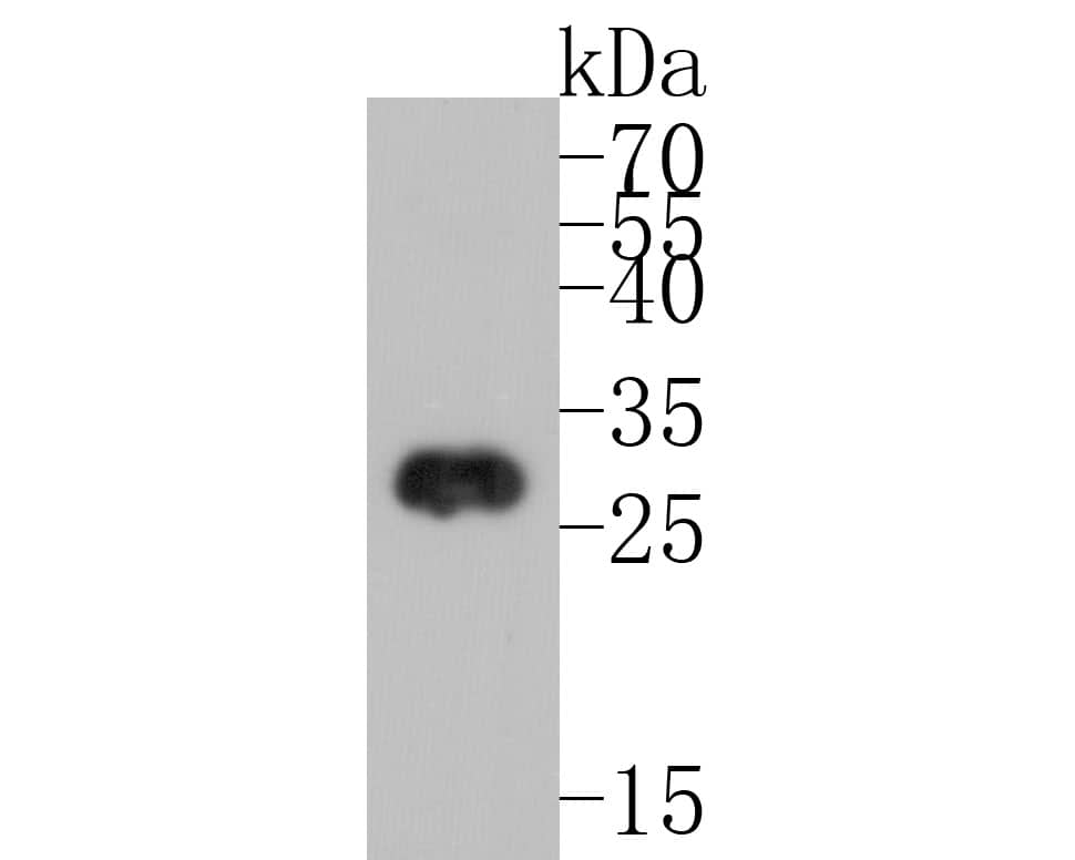 Western blot analysis of RFP on RFP recombinant protein. Proteins were transferred to a PVDF membrane and blocked with 5% BSA in PBS for 1 hour at room temperature. NBP2-67102 was used in 5% BSA at room temperature for 2 hours. Goat Anti-Rabbit IgG [HRP] Secondary Antibody at 1:5,000 dilution was used for 1 hour at room temperature.
