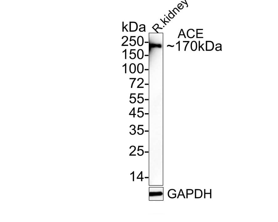 Western blot analysis of  rat kidney tissue lysates with NBP2-67111 at 1/1,000 dilution. Lysates/proteins at 10 µg/Lane. Predicted band size: 150 kDa Observed band size: 170 kDa Exposure time: 1 minutes 150 seconds; 4-20% SDS-PAGE gel. Proteins were transferred to a PVDF membrane and blocked with 5% NFDM/TBST for 1 hour at room temperature. NBP2-67111 at 1/1,000 dilution was used in 5% NFDM/TBST at 4℃ overnight. Goat Anti-Rabbit IgG [HRP] Secondary Antibody at 1/50,000 dilution was used for 1 hour at room temperature.