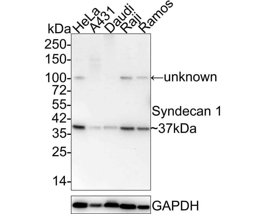 Western blot analysis on different lysates with NBP2-67174 at 1/2,000 dilution. Lane 1: HeLa cell lysate Lane 2: A431 cell lysate Lane 3: Daudi cell lysate Lane 4: Raji cell lysate Lane 5: Ramos cell lysate Lysates/proteins at 20 µg/Lane. Predicted band size: 33 kDa Observed band size: 37 kDa Exposure time: 3 minutes; 4-20% SDS-PAGE gel. Proteins were transferred to a PVDF membrane and blocked with 5% NFDM/TBST for 1 hour at room temperature. NBP2-67174 at 1/2,000 dilution was used in 5% NFDM/TBST at 4℃ overnight. Goat Anti-Rabbit IgG [HRP] Secondary Antibody at 1:50,000 dilution was used for 1 hour at room temperature.