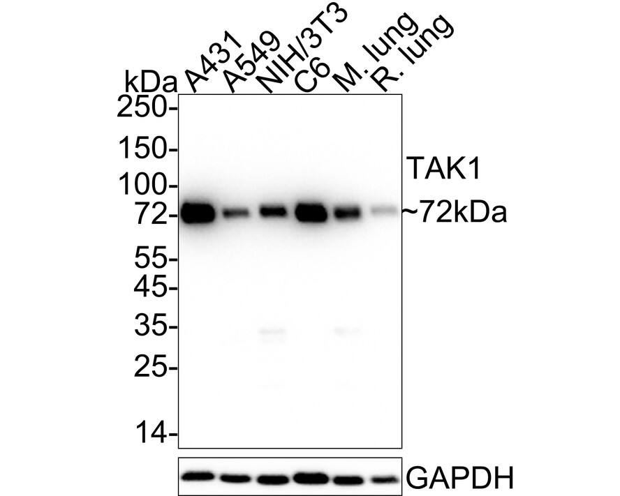 Western blot analysis on different lysates with NBP2-67180 at 1/1,000 dilution. Lane 1: A431 cell lysate (20 µg/Lane) Lane 2: A549 cell lysate (20 µg/Lane) Lane 3: NIH/3T3 cell lysate (20 µg/Lane) Lane 4: C6 cell lysate (20 µg/Lane) Lane 5: Mouse lung tissue lysate (40 µg/Lane) Lane 6: Rat lung tissue lysate (40 µg/Lane) Predicted band size: 67 kDa Observed band size: 72 kDa Exposure time: 10 seconds;  4-20% SDS-PAGE gel. Proteins were transferred to a PVDF membrane and blocked with 5% NFDM/TBST for 1 hour at room temperature. NBP2-67180 at 1/1,000 dilution was used in 5% NFDM/TBST at 4℃ overnight. Goat Anti-Rabbit IgG [HRP] Secondary Antibody at 1/50,000 dilution was used for 1 hour at room temperature.