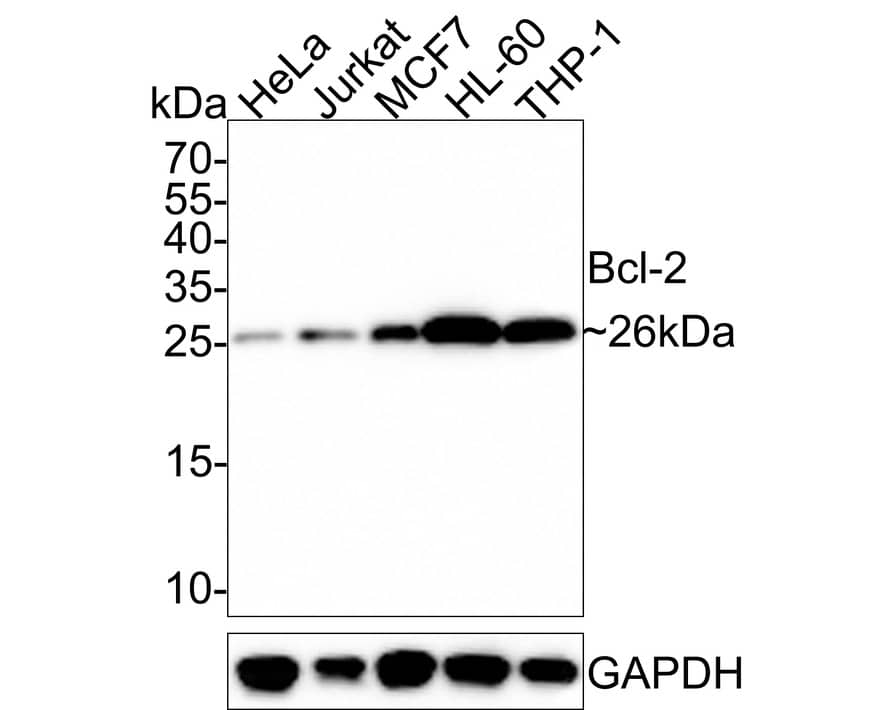 Western blot analysis on different lysates with NBP2-67182 at 1/5,000 dilution. Lane 1: HeLa cell lysate Lane 2: Jurkat cell lysate Lane 3: MCF7 cell lysate Lane 4: HL-60 cell lysate Lane 5: THP-1 cell lysate Lysates/proteins at 20 µg/Lane. Predicted band size: 26 kDa Observed band size: 26 kDa Exposure time: 1 minute; 15% SDS-PAGE gel. Proteins were transferred to a PVDF membrane and blocked with 5% NFDM/TBST for 1 hour at room temperature. NBP2-67182 at 1/5,000 dilution was used in 5% NFDM/TBST at room temperature for 2 hours. Goat Anti-Rabbit IgG [HRP] Secondary Antibody at 1/50,000 dilution was used for 1 hour at room temperature.