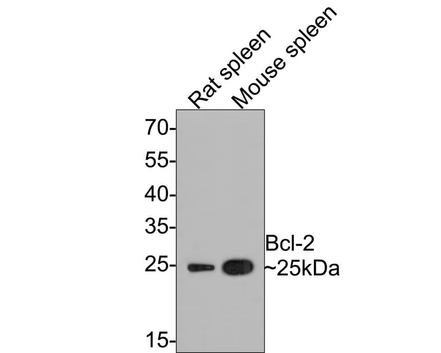 Western blot analysis on different lysates with NBP2-67182 at 1/5,000 dilution. Lane 1: Rat spleen tissue lysate Lane 2: Mouse spleen tissue lysate Lysates/proteins at 20 µg/Lane. Predicted band size: 26 kDa Observed band size: 25 kDa Exposure time: 2 minutes; 12% SDS-PAGE gel. Proteins were transferred to a PVDF membrane and blocked with 5% NFDM/TBST for 1 hour at room temperature. NBP2-67182 at 1/5,000 dilution was used in 5% NFDM/TBST at room temperature for 2 hours. Goat Anti-Rabbit IgG [HRP] Secondary Antibody at 1/50,000 dilution was used for 1 hour at room temperature.
