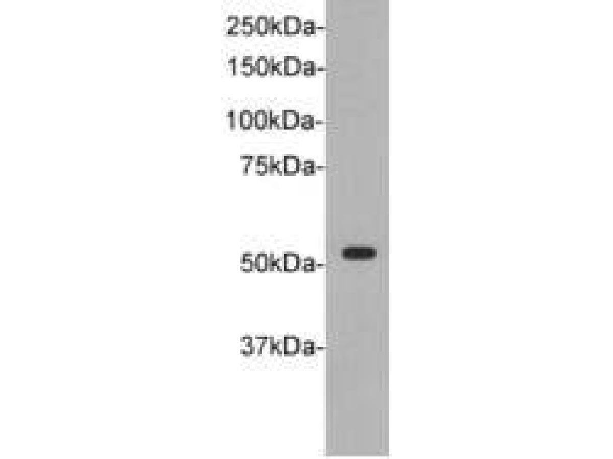 Western blot analysis on A :Jurkat B:Hela cell lysates using NBP2-67185