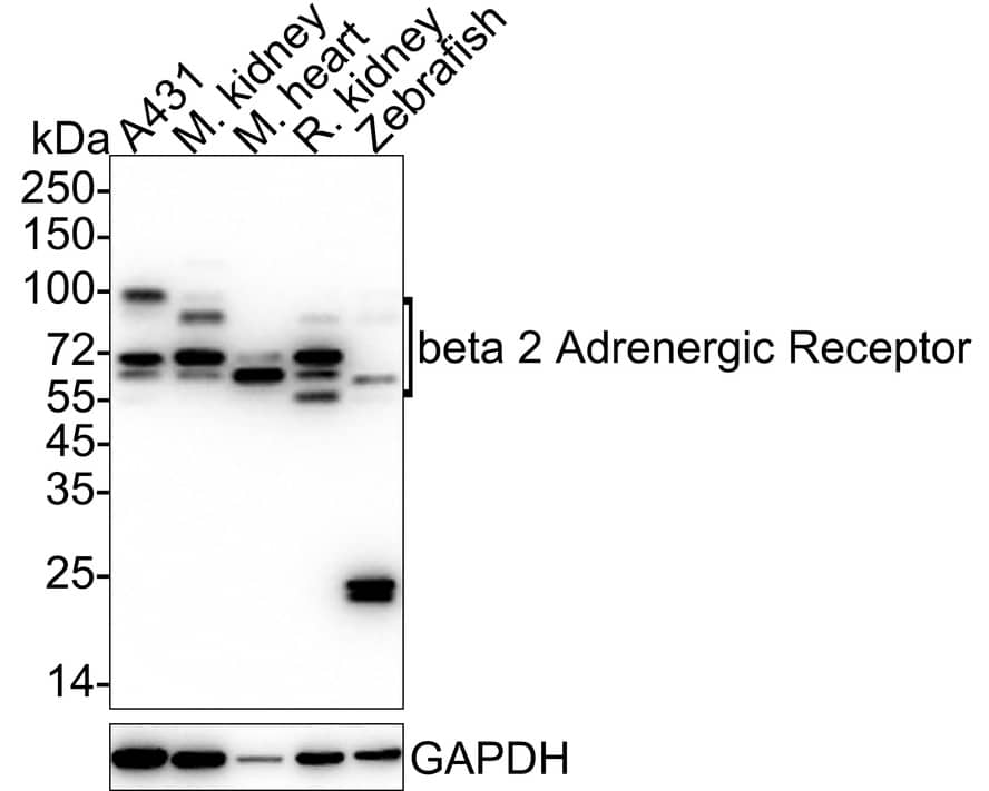 Western Blot beta-2 Adrenergic R/ADRB2 Antibody (JM102-06)
