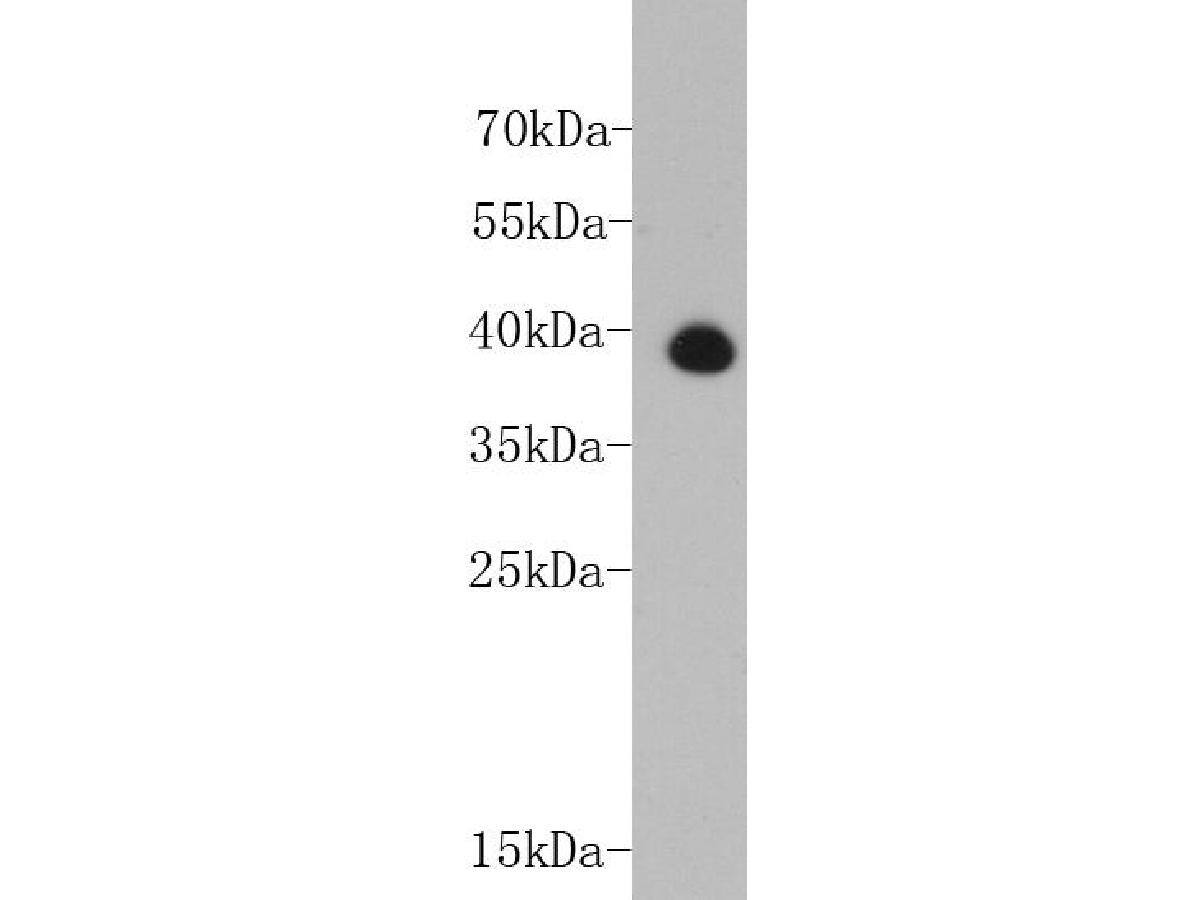 Western blot analysis of human heart tissue lysate NBP2-67211 at 1/2,000 dilution.