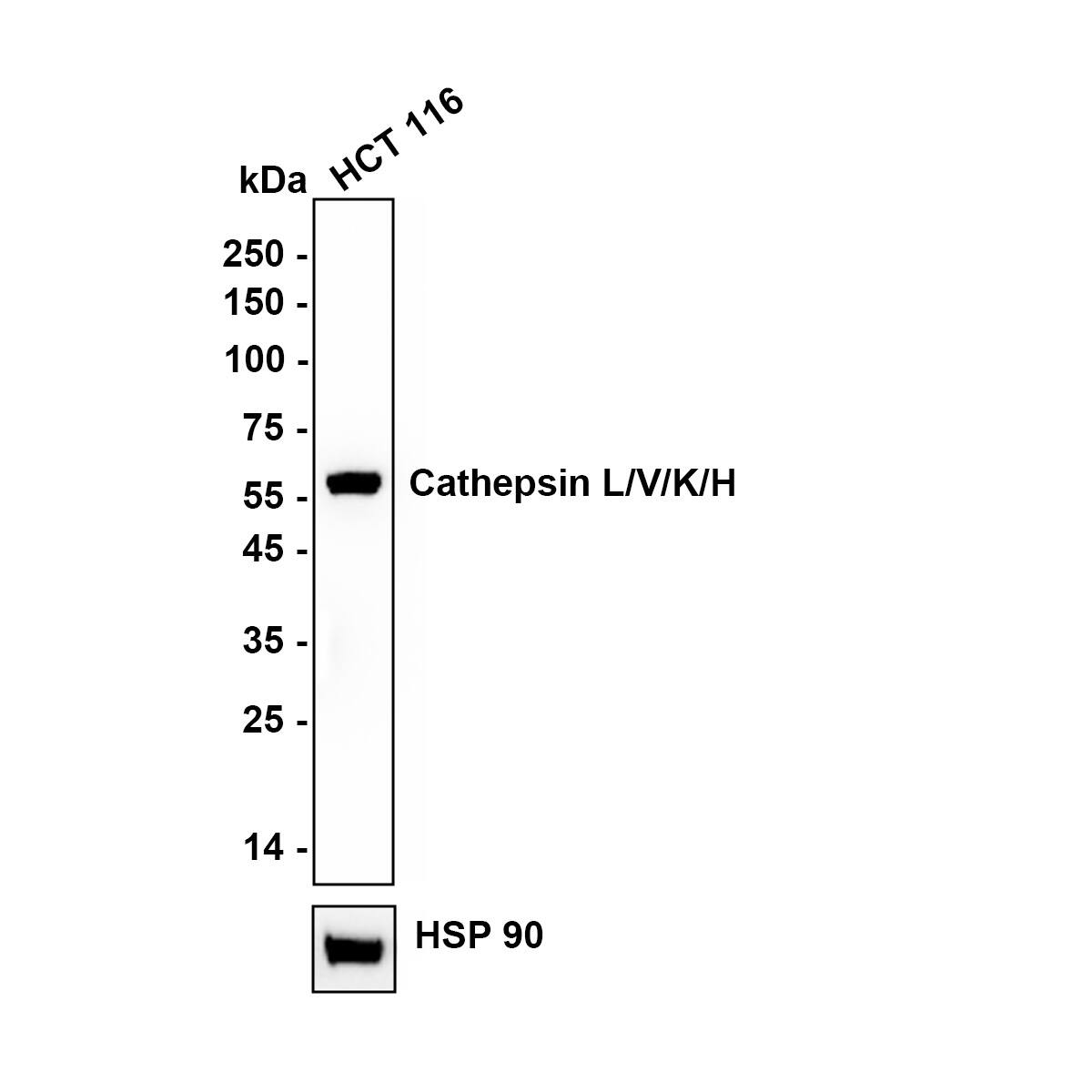 Western blot analysis of  HCT 116 cell lysate with NBP2-67216 at 1/2,000 dilution. Lysates/proteins at 15 µg/Lane. Exposure time: 1 minutes Blocking: 5% NFDM/TBST, 1 hour at room temperature Primary antibody: NBP2-67216, 1/2,000 in primary antibody dilution buffer, overnight at 4 ℃ Secondary antibody: Goat Anti-Rabbit IgG [HRP] Secondary Antibody, 1/50,000 in 5% NFDM/TBST, 1 hour at room temperature Predicted band size: 37/38 kDa Observed band size: 56 kDa