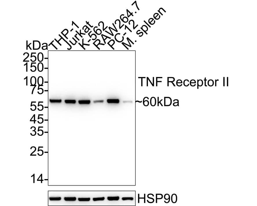 Western blot analysis on different lysates with NBP2-67218 at 1/2,000 dilution. Lane 1: THP-1 cell lysate (20 µg/Lane) Lane 2: Jurkat cell lysate (20 µg/Lane) Lane 3: K-562 cell lysate (20 µg/Lane) Lane 4: RAW264.7 cell lysate (20 µg/Lane) Lane 5: PC-12 cell lysate (20 µg/Lane) Lane 6: Mouse spleen tissue lysate (40 µg/Lane) Predicted band size: 48 kDa Observed band size: 60 kDa Exposure time: 10 seconds;  4-20% SDS-PAGE gel. Proteins were transferred to a PVDF membrane and blocked with 5% NFDM/TBST for 1 hour at room temperature. NBP2-67218 at 1/2,000 dilution was used in 5% NFDM/TBST at 4℃ overnight. Goat Anti-Rabbit IgG [HRP] Secondary Antibody at 1/50,000 dilution was used for 1 hour at room temperature.