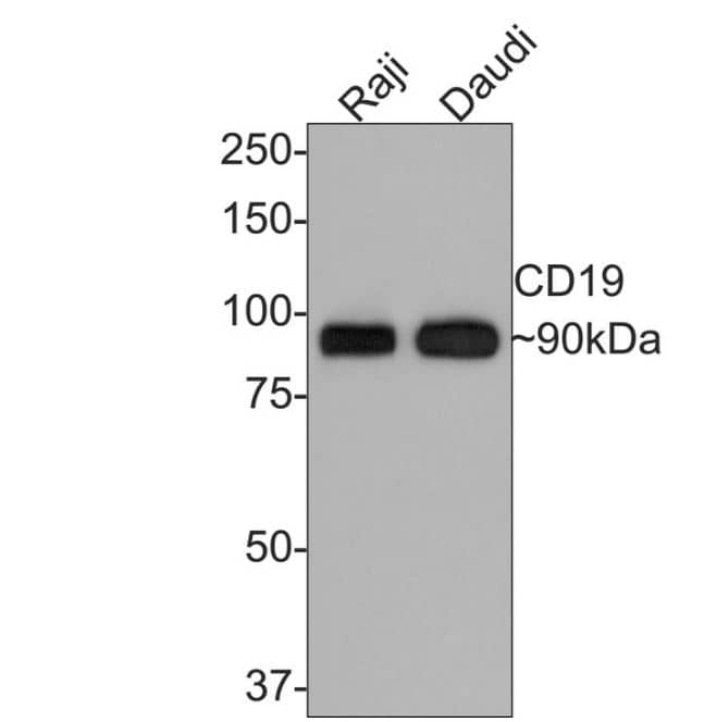 Western Blot: CD19 Antibody (JF100-06) [NBP2-67229] -Analysis of CD19 on different lysates with Rabbit anti-CD19 antibody at 1/1,000 dilution.Lane 1: Raji cell lysateLane 2: Daudi cell lysateLysates/proteins at 10 ug/Lane.Predicted band size: 61 kDaObserved band size: 90 kDaExposure time: 2 minutes;8% SDS-PAGE gel.Proteins were transferred to a PVDF membrane and blocked with 5% NFDM/TBST for 1 hour at room temperature. The primary antibody at 1/1,000 dilution was used in 5% NFDM/TBST at room temperature for 2 hours. Goat Anti-Rabbit IgG - HRP Secondary Antibody at 1:300,000 dilution was used for 1 hour at room temperature.