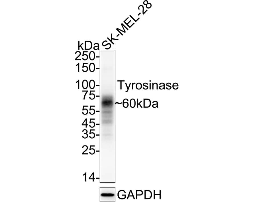 Western blot analysis of  SK-MEL-28 cell lysates with NBP2-67232 at 1/2,000 dilution. Lysates/proteins at 20 µg/Lane. Predicted band size: 60 kDa Observed band size: 60 kDa Exposure time: 46 seconds; 4-20% SDS-PAGE gel. Proteins were transferred to a PVDF membrane and blocked with 5% NFDM/TBST for 1 hour at room temperature. NBP2-67232 at 1/2,000 dilution was used in 5% NFDM/TBST at 4℃ overnight. Goat Anti-Rabbit IgG [HRP] Secondary Antibody at 1/50,000 dilution was used for 1 hour at room temperature.